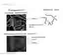 Fig. 10 - Redox polymerization method, water-absorbent resin composite, and absorbent article
