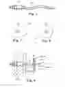 Fig. 05 - Methods and Apparatus for Securing and Tensioning a Urethral Sling to Pubic Bone