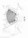 Fig. 07 - Methods and Apparatus for Securing and Tensioning a Urethral Sling to Pubic Bone