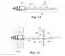 Fig. 09 - Methods and Apparatus for Securing and Tensioning a Urethral Sling to Pubic Bone