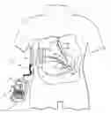 Fig. 01 - Magnetic resonance imaging (MRI) safe remotely adjustable artifical sphincter