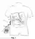 Fig. 02 - Magnetic resonance imaging (MRI) safe remotely adjustable artifical sphincter
