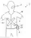 Fig. 01 - Capsule endoscope apparatus