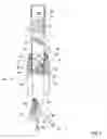 Fig. 04 - Endoscopic apparatus provided with inflatable propelling sleeve