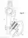 Fig. 23 - Medical devices and systems