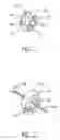 Fig. 02 - Medical port device, kit and associated method