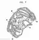 Fig. 06 - Software product for three-dimensional cardiac imaging using ultrasound contour reconstruction