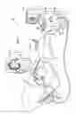 Fig. 02 - Registration of electro-anatomical map with pre-acquired image using ultrasound