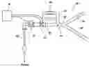 Fig. 01 - Methods and apparatus for improving time domain relationships between signals obtained from respiration