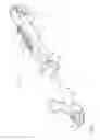 Fig. 02 - Anastomotic ring applier with inflatable members