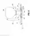Fig. 03 - Guidewire loader apparatus and method