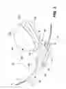 Fig. 04 - Guidewire loader apparatus and method