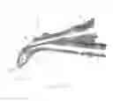 Fig. 04 - Soft-flow aortic cannula tip