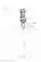 Fig. 08 - Soft-flow aortic cannula tip