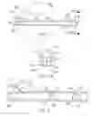 Fig. 02 - Security tip for vascular catheter and method of using same