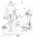 Fig. 02 - Patient hydration system with hydration state detection
