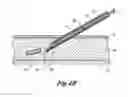 Fig. 04 - Instrument for implanting sensors and solid materials in a subcutaneous location and method thereof
