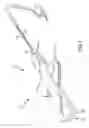 Fig. 02 - Bi-directional handle for a catheter