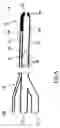 Fig. 05 - Diagnostic catheter and its method of application