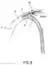 Fig. 09 - Diagnostic catheter and its method of application