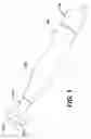 Fig. 04 - Stratum corneum piercing device