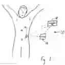 Fig. 02 - Medical needles for damping motion