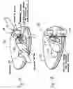 Fig. 11 - Medical needles for damping motion