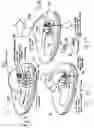 Fig. 12 - Medical needles for damping motion