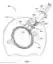 Fig. 04 - Method and apparatus for facilitating evacuation and cleansing of a colonostomy bag