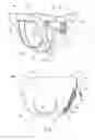 Fig. 04 - Disposable absorbent articles having multiple absorbent core components including replaceable components