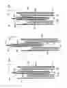 Fig. 33 - Disposable absorbent articles having multiple absorbent core components including replaceable components