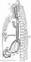 Fig. 01 - Method for gastric cooling using balloon catheter