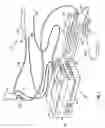 Fig. 06 - Method for gastric cooling using balloon catheter