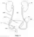 Fig. 02 - Non-expandable transluminal access sheath
