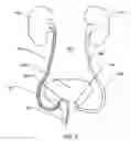 Fig. 03 - Non-expandable transluminal access sheath