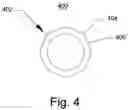 Fig. 05 - Non-expandable transluminal access sheath