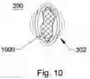Fig. 11 - Non-expandable transluminal access sheath
