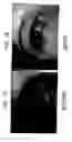 Fig. 02 - Cosmetic laser treatment device and method for localized lipodystrophies and flaccidity