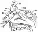 Fig. 01 - Systems and methods for electrosurgical treatment of obstructive sleep disorders