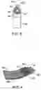 Fig. 04 - Systems and methods for electrosurgical treatment of obstructive sleep disorders
