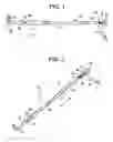 Fig. 02 - Apparatus and method for positioning an implant during surgery
