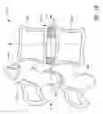 Fig. 03 - Minimally invasive method for delivery and positioning of intervertebral disc implants