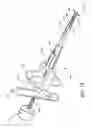 Fig. 08 - Minimally invasive method for delivery and positioning of intervertebral disc implants