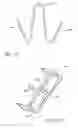 Fig. 24 - Minimally invasive method for delivery and positioning of intervertebral disc implants