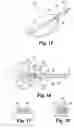 Fig. 07 - Method of preparing an implant for delivery into a vertebral space