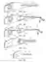 Fig. 02 - Port extraction method for trans-organ surgery