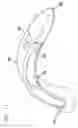 Fig. 08 - Surgical tool for electrode implantation