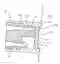 Fig. 01 - Microdermabrasion method and apparatus