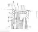 Fig. 08 - Microdermabrasion method and apparatus
