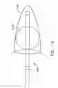 Fig. 17 - Apparatus and method for the ligation of tissue